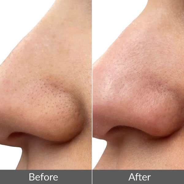 Pmd Beauty PMD Wave Pro – For Men Device