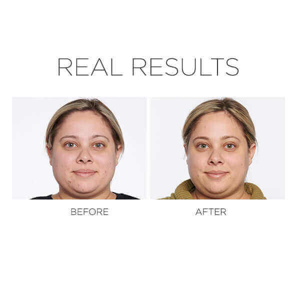 Pür Cosmetics 4-in-1 Correcting Primer Anti-Blemish & Mattifying Primer