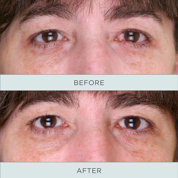 Pür Cosmetics Tone Up Niacinamide Firming Eye Serum