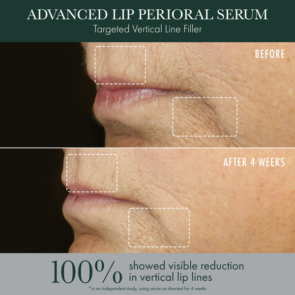 Révive Advanced Lip Perioral Serum / Targeted Vertical Line Filler