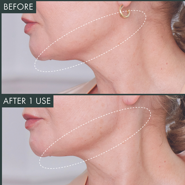 Révive Fermitif Chin Contour / Instant Tightening Peptide Mask