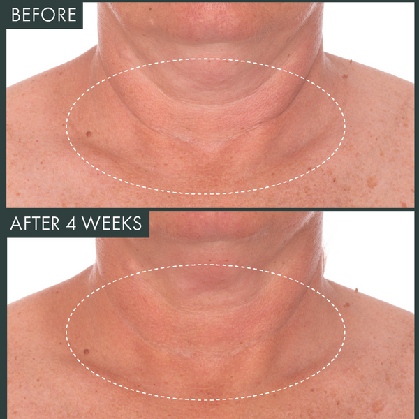 Révive Fermitif Neck Renewal Night Cream / Firming Moisturizer