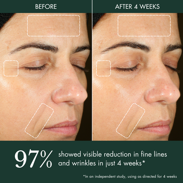 Révive Hydrogel Moisturizer / Hyaluronic Acid Water Cream