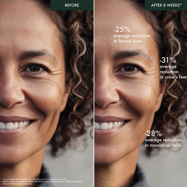 Révive Intensité Volumizing Serum Ultime / Targeted Skin Filler