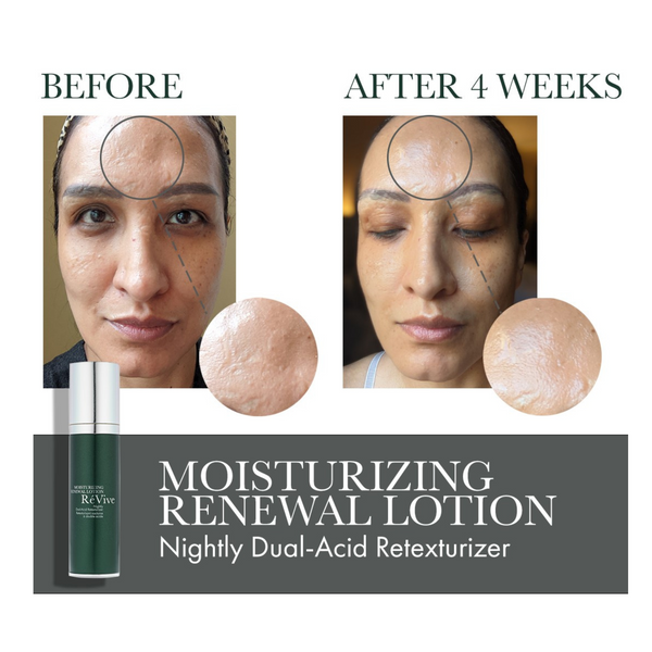 Révive Moisturizing Renewal Lotion/ Nightly Dual-Acid Retexturizer