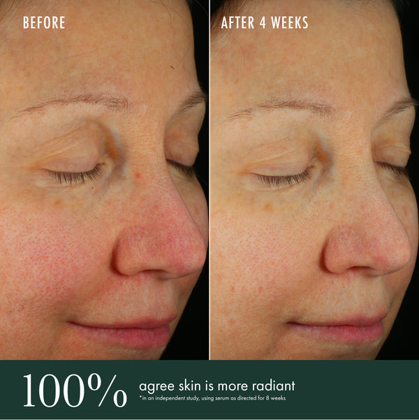 Révive Brightening Serum / Skin Illuminator