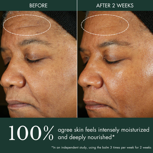 Révive Rescue Balm / Overnight Mask