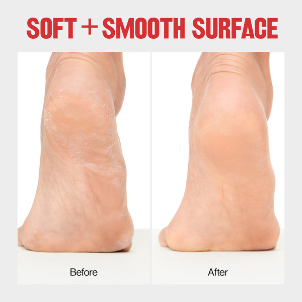 Revlon Wet/Dry Foot File - Pedicure Tool