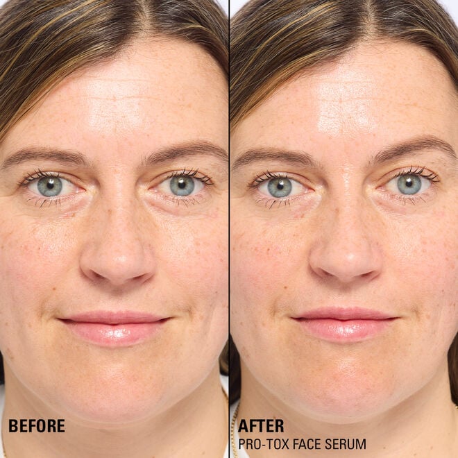 Revolution Beauty London Revolution Pro Miracle Pro-Tox Fine Line Fix & Fill Serum 30ml