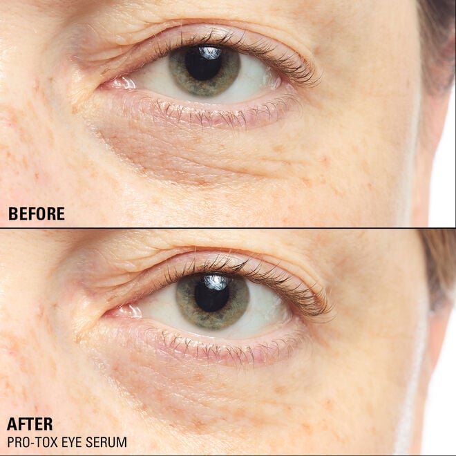 Revolution Beauty London Revolution Pro Miracle Pro-Tox Instant Fix Eye Firm