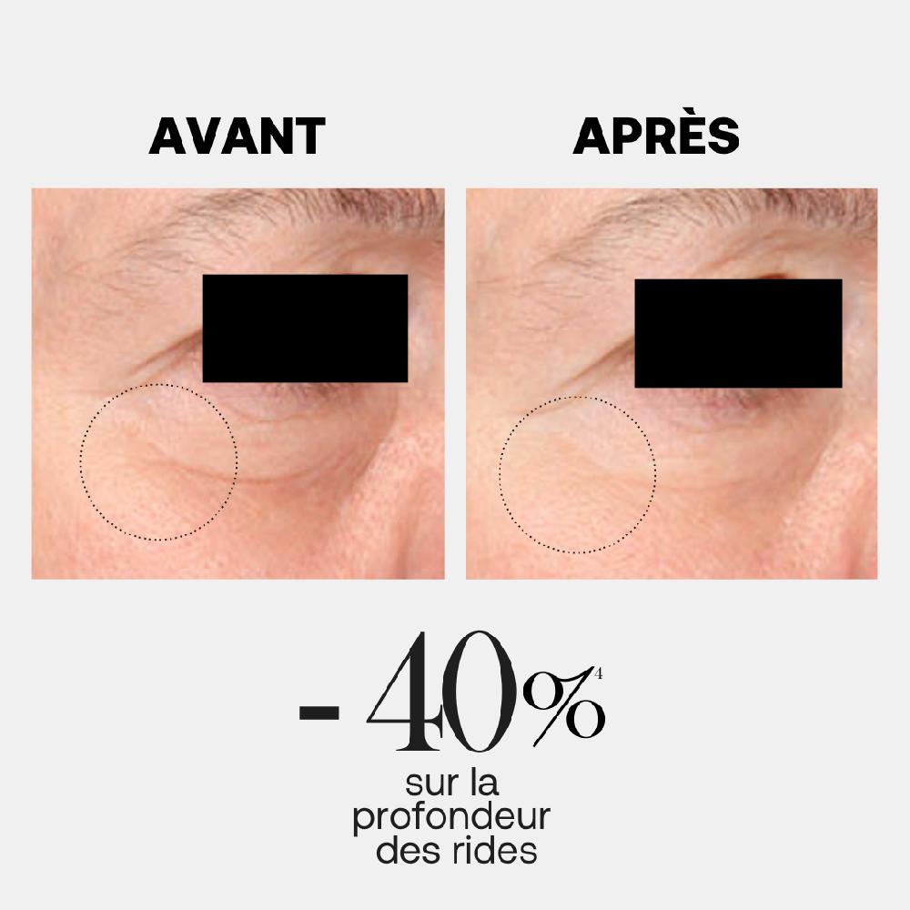 Rexaline Line Killer Eye - Anti-aging Eye Contour Treatment