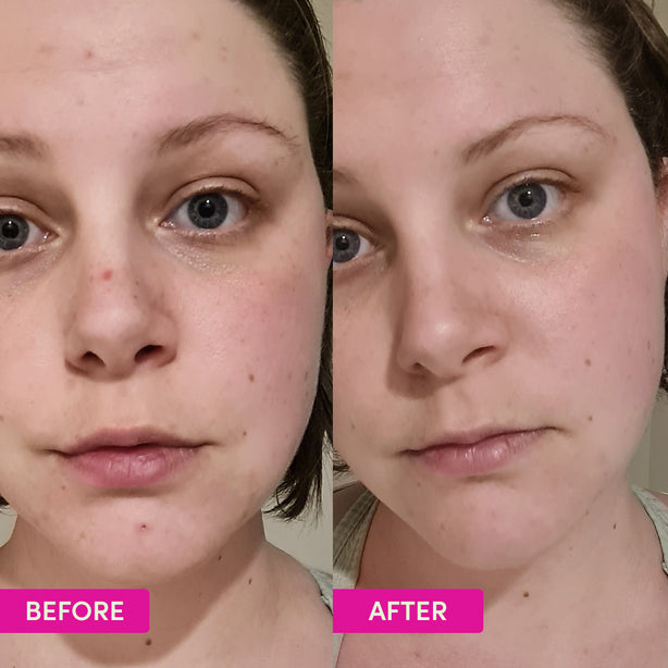 Sand & Sky Australian Glow Berries Intense Glow Moisturizer (60g)