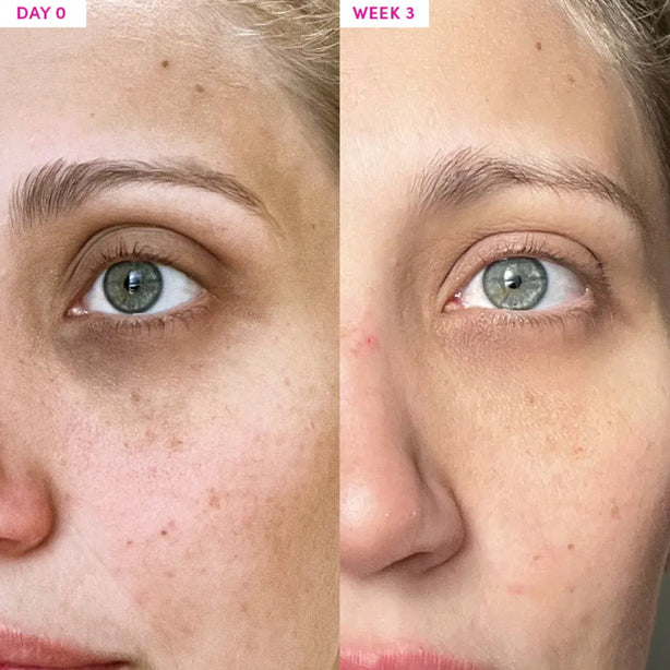 Sand & Sky Anti-aging Eye Cream