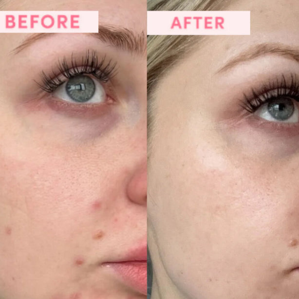 Sand & Sky Australian Pink Clay Resurfacing Mask