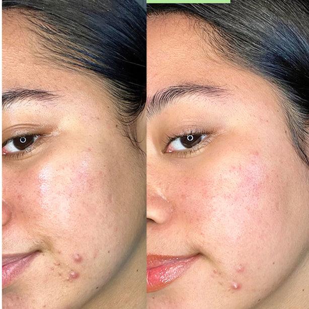 Sand & Sky Oil Control Clearing Face Mask (100g)