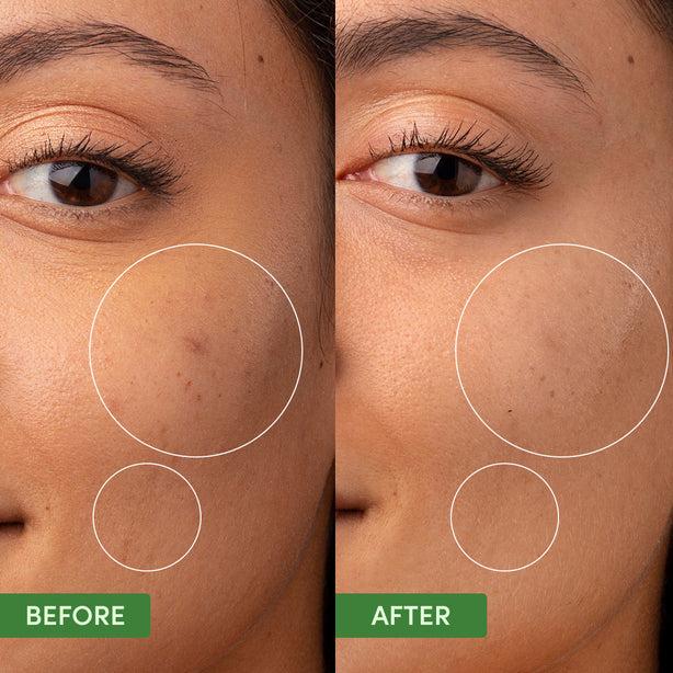 Sand & Sky Oil Control Clearing Moisturizer (2.12oz)