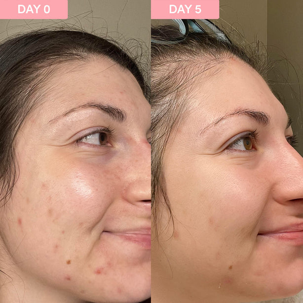 Sand & Sky Pro Youth Dark Spot Serum (30ml)