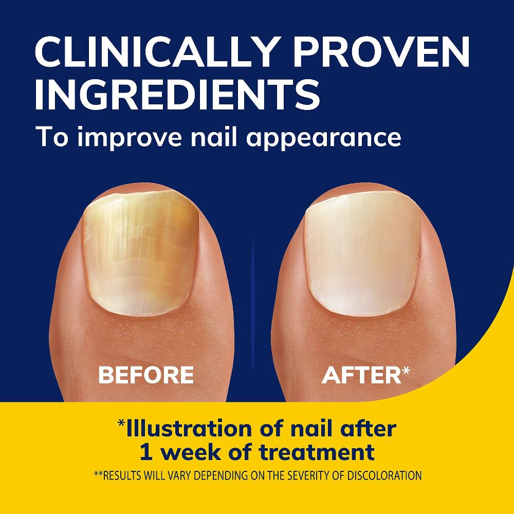 Scholl Fungal Nail Revitalizer Liquid & Refill