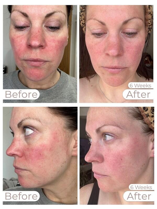 Seraphine Stylpro Wavelength LED Face Mask