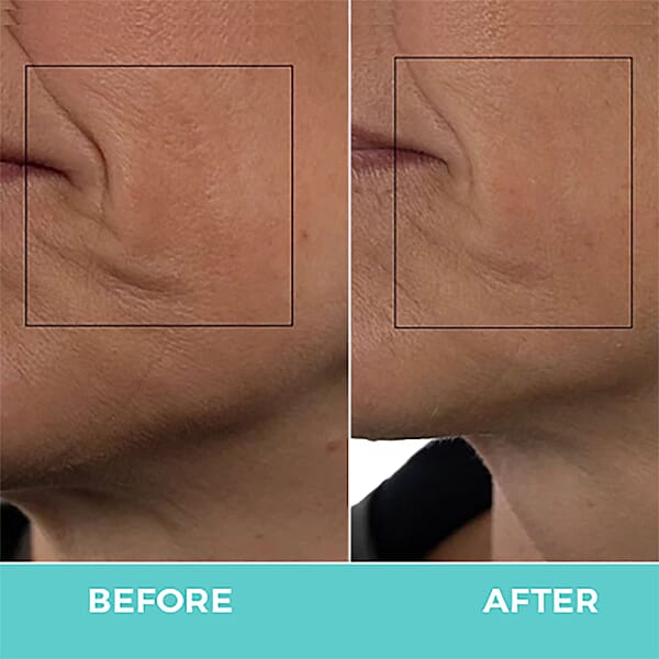 Shop Lc Nuovaluce Mini Plus Microcurrent Skincare Device Bundle With Silver Conductive Gel And Travel Case (2 Years Warranty)