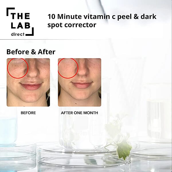 Shop Lc The Lab Direct 10 Minute Vitamin C Peel 2oz (Made In USA) Anti Wrinkle Anti Aging Skin Care Products (Ships In 5-7 Business Days)