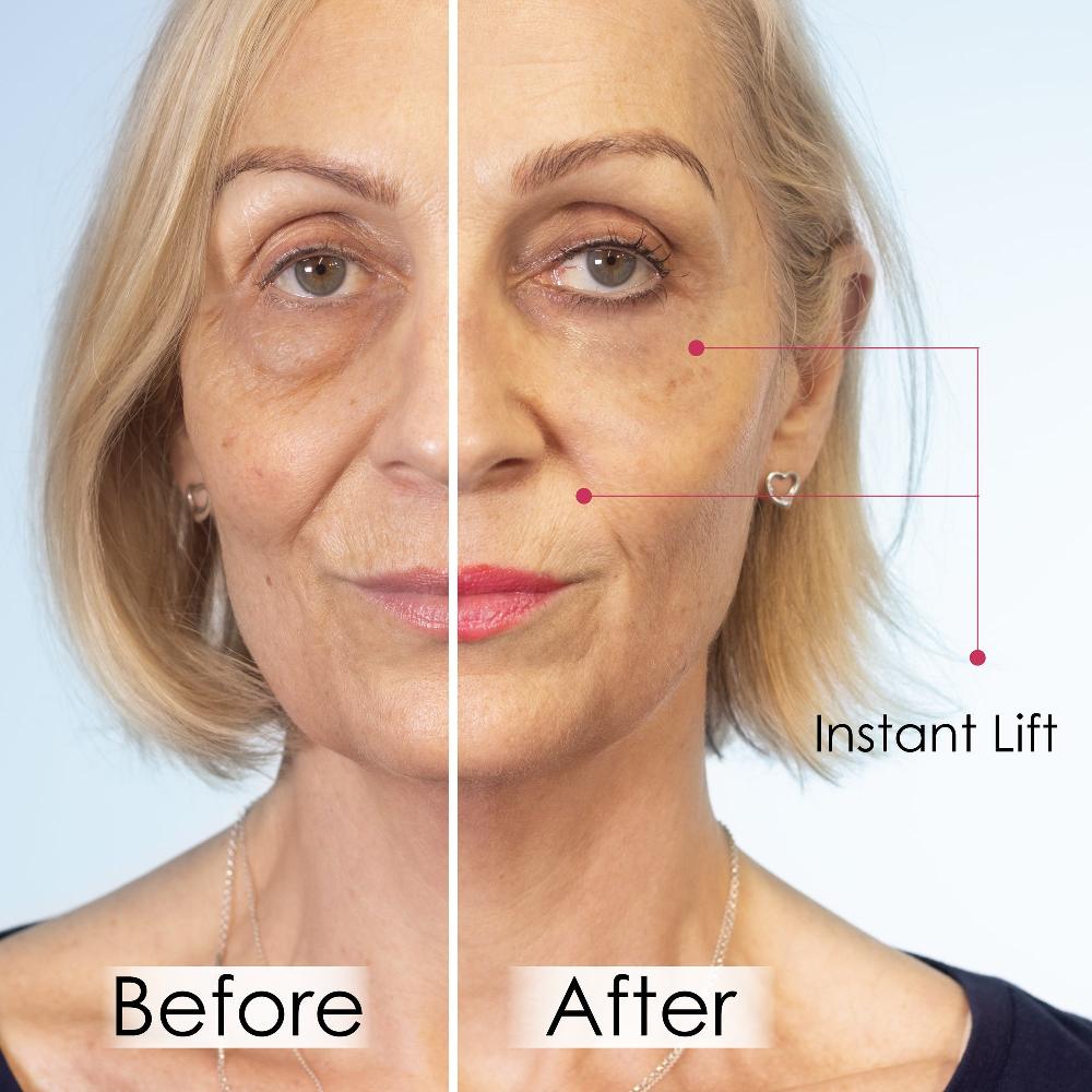 Skin Chemist Wrinkle Killer Instant Lift With Hyaluronic Acid & Peptides