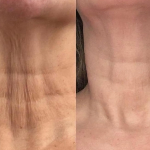 Skin O2 Neck & Body Cream — Skin O2