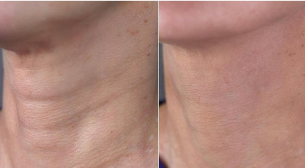 Skin O2 Neck & Body Cream — Skin O2