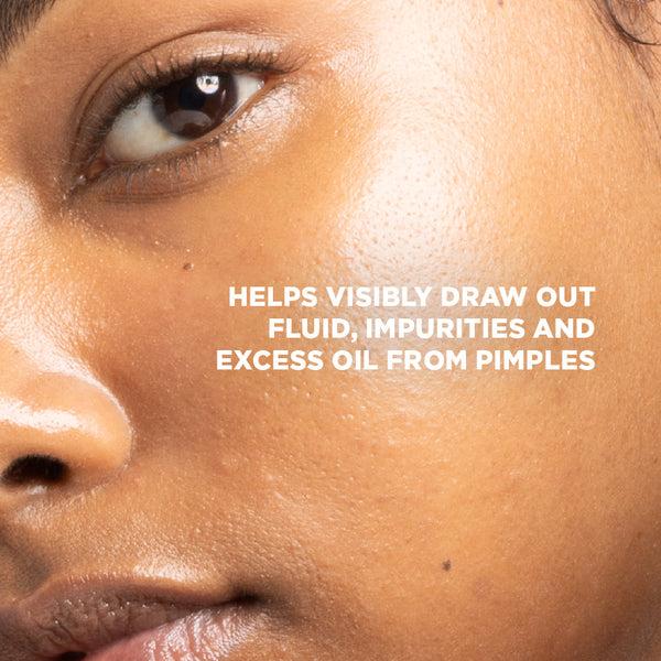 Skin Republic Treat Large Breakout Areas Skin Republic XL Spot Clear Patch Hydrocolloid Pimple Patch (10 Patches) - Skin Republic South Africa