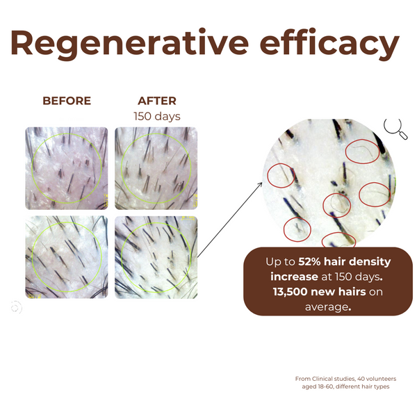 Standard Peptide Miracle Hair Growth Serum With Rosemary Extract & Plant-Stem-Cells