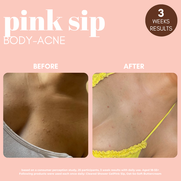 Standard Pink Sip Body Mist With Rose Water & 2% Salicylic Acid