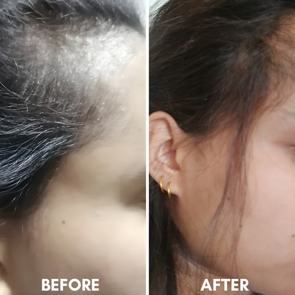 Standard Hot Oil Hair Therapy With Rosemary