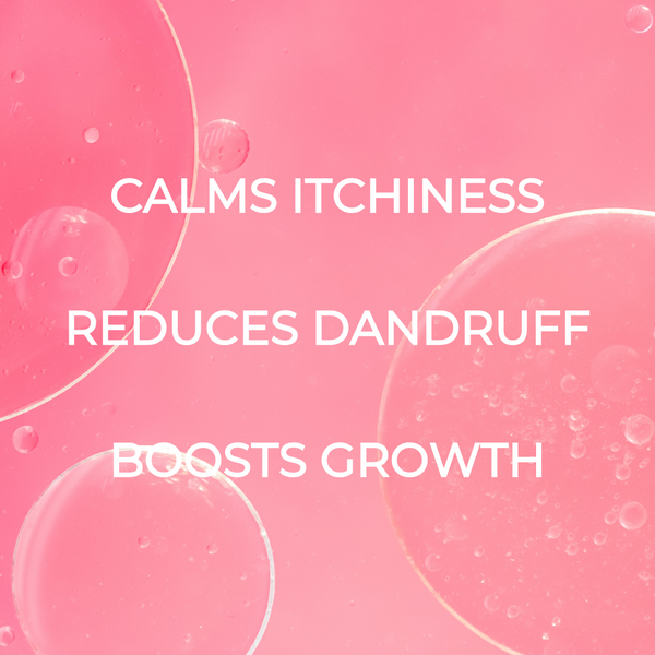 Standard SOS Scalp Spray