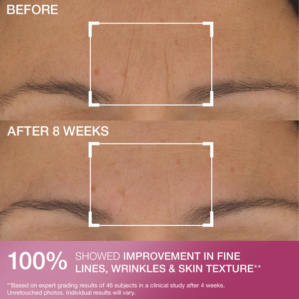 Strivectin S.T.A.R. Light® Retinol Night Oil