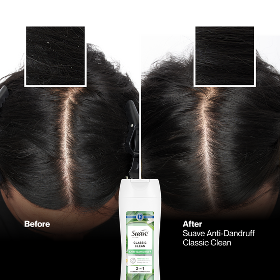 Suave Classic Clean Anti Dandruff 2-in-1 Shampoo & Conditioner
