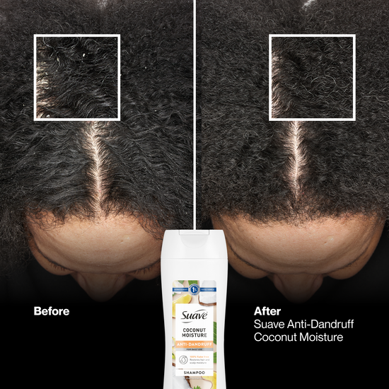 Suave Coconut Moisture Anti Dandruff Shampoo