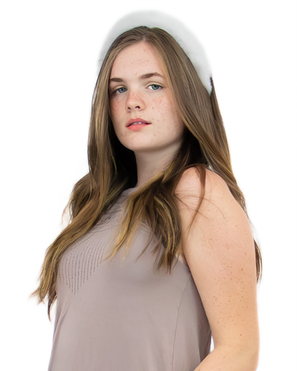 Surell Faux Rex Rabbit Fur Hairband